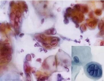 (li)ϴӣךWM(jn)ھϴOꑌҼ